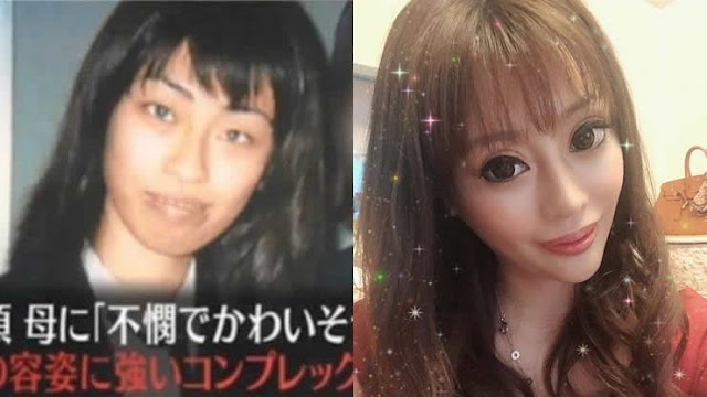 Japanese Women Had Plastic Surgery After Trauma Her Mother Is Always Dissatisfied With Her Looks