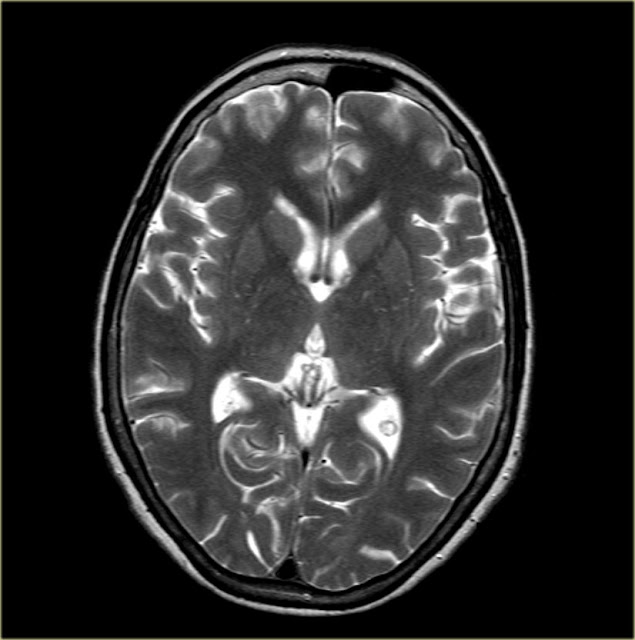 Brain Radiology1