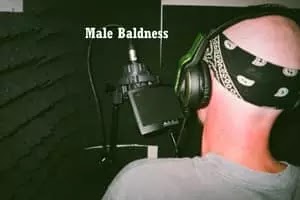 male baldness