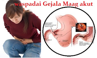 harga gastriic health tablet