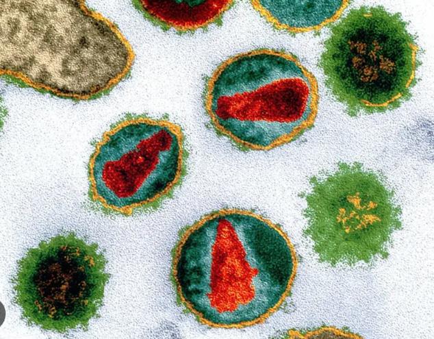 Virus HIV Diamati Pada Mikroskop Elektron