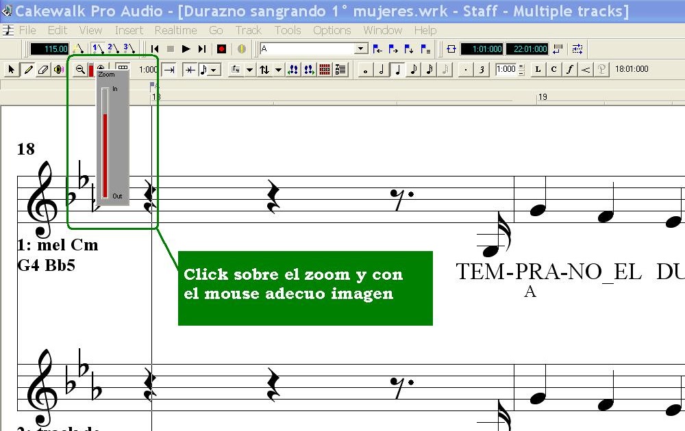 Arte y Parte Musical 05 Las vocales de una canción.