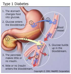 Akibat Diabetes Melitus, Organ Tubuh Bisa Terserang ?