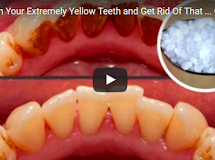 Whiten Your extremely Yellow-teeth and do away with That Nasty Tartar Build up and Plaque With This!