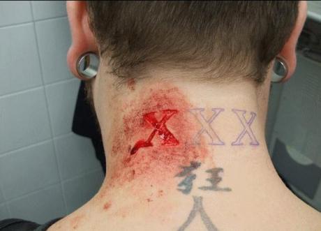 It is triple x scar tattoo on neck maybe this guy is a truly fan of the 