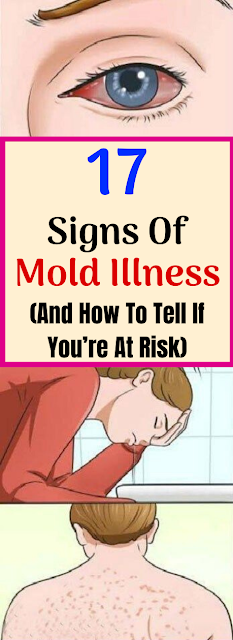 17 Signs of Mold Illness and How to Tell If You Are at Risk