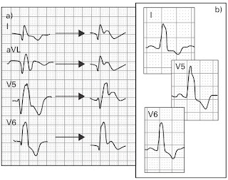 KUIS EKG kasus 2