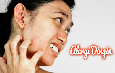 Nama Obat Gatal Alergi Bentol Kulit Alergi Udara Dingin Dan Makanan