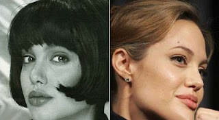 Angelina Jolie Rhinoplasty (Nose Job)