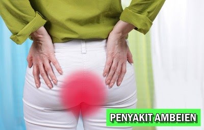 Contoh Gambar Dan Harga Obat Ambeclear Untuk Ibu Menyusui