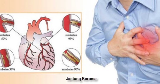Cara Mencegah Penyakit Organ Peredaran Darah, Tema 4