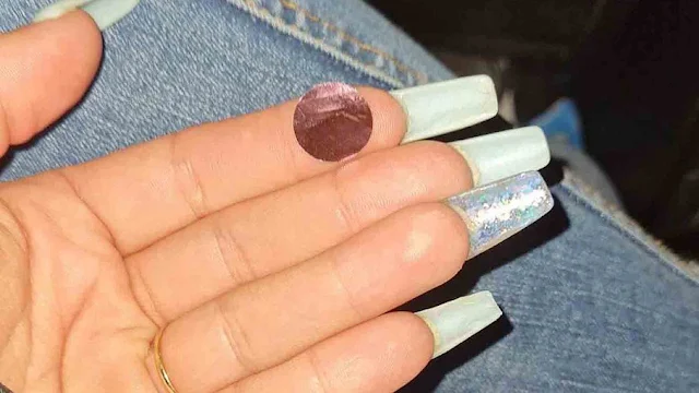 Mãe encontra buraco dentro da boca de bebê e passa vergonha no hospital
