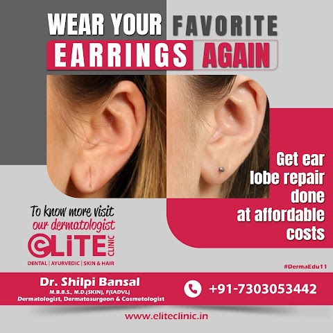 Ear Lobe Repair - Social Media Post