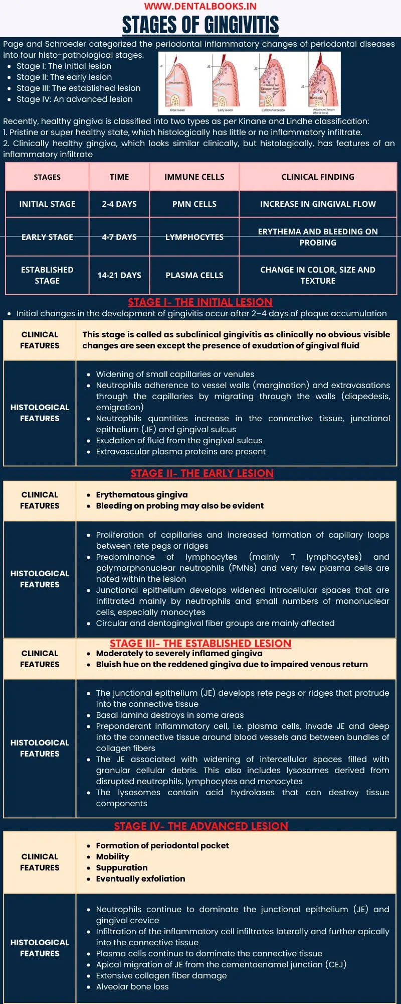 Gingivitis- Introduction, Classification, Stages and Clinical Features | Periodontics Lectures | Dental Notes