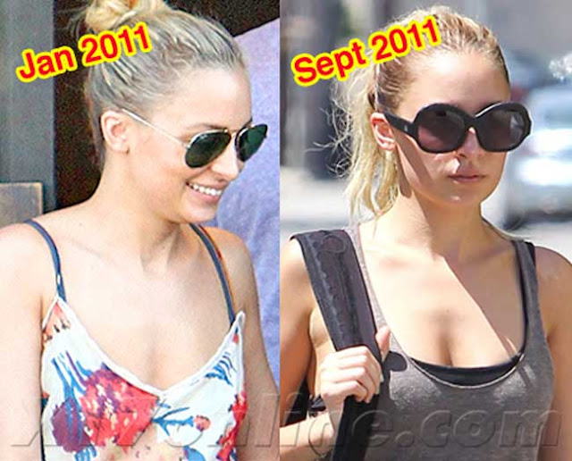 Nicole Richie Boob Job Then and Now