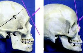 Two skulls in profile view showing a skull with a sloping forehead and one with a vertical forehead.