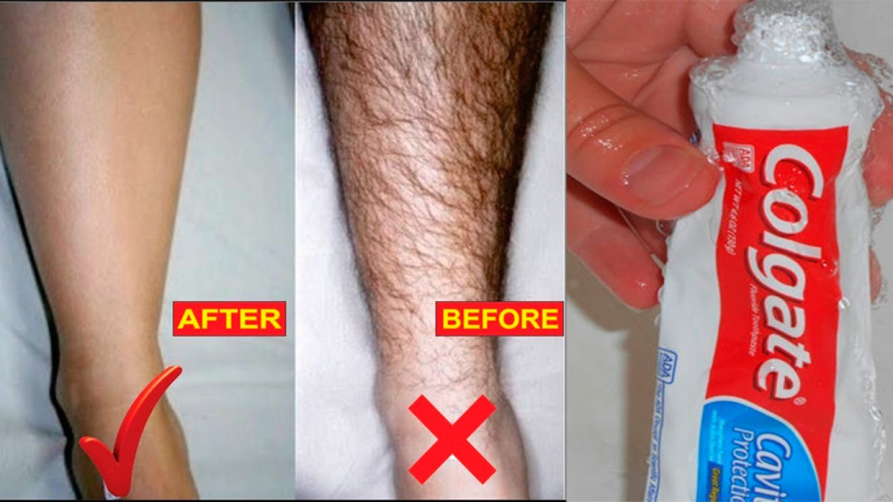 toothpaste hair removal cream