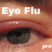 What is eye flu and how it happens.2023.