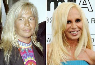 Plastic Surgery