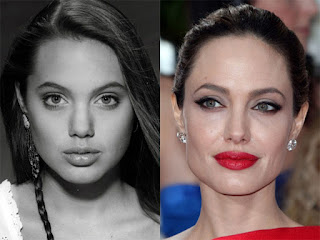 Angelina Jolie has undergone several surgeries on her face and these photos prove it