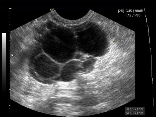 Berita dan info kesehatan USG UltraSonoGrafi 