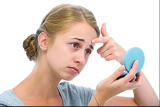 Setting Guidelines for Acne Treatment