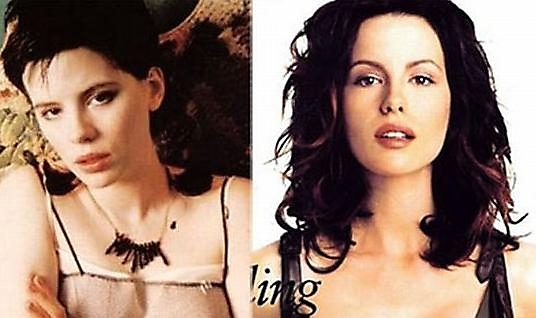 katebeckinsalesurgery20%255B1%255D Hollywood Celebs Before & After Surgery