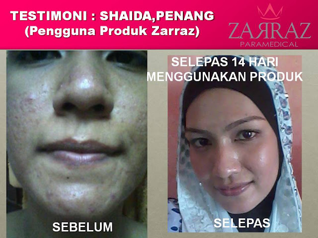 Testimoni ~ Zarraz Paramedical