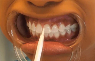 how to make teeth whiter in 3 minutes