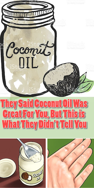 They Said Coconut Oil Was Great For You, But This is What They Didn’t Tell You