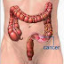 Who Is More Vulnerable to Build Colorectal Cancer?