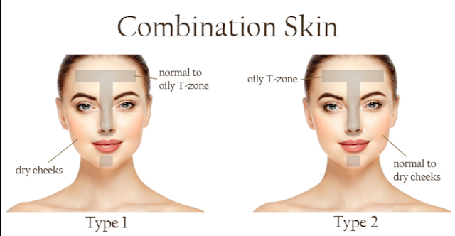 Combination Skin Type