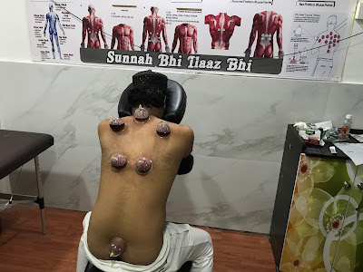 Courses for Hijama Cupping Therapy