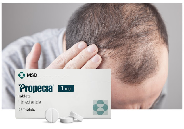 pros and cons of finasteride male hair loss treatment