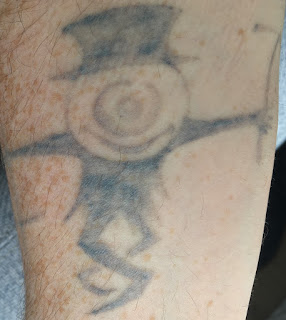 Tattoo Fading and Healing After Six Picosure Sessions