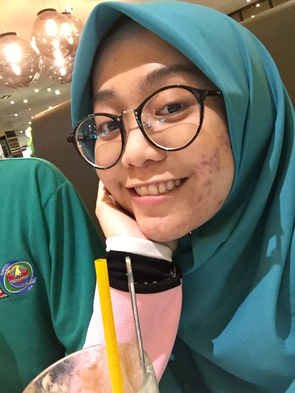 MUKA TERUK DISEBABKAN PRODUK TEMPATAN