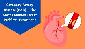 Heart Failure: Prevention Insights