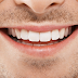 What to Look For When Choosing a Cosmetic Dentist