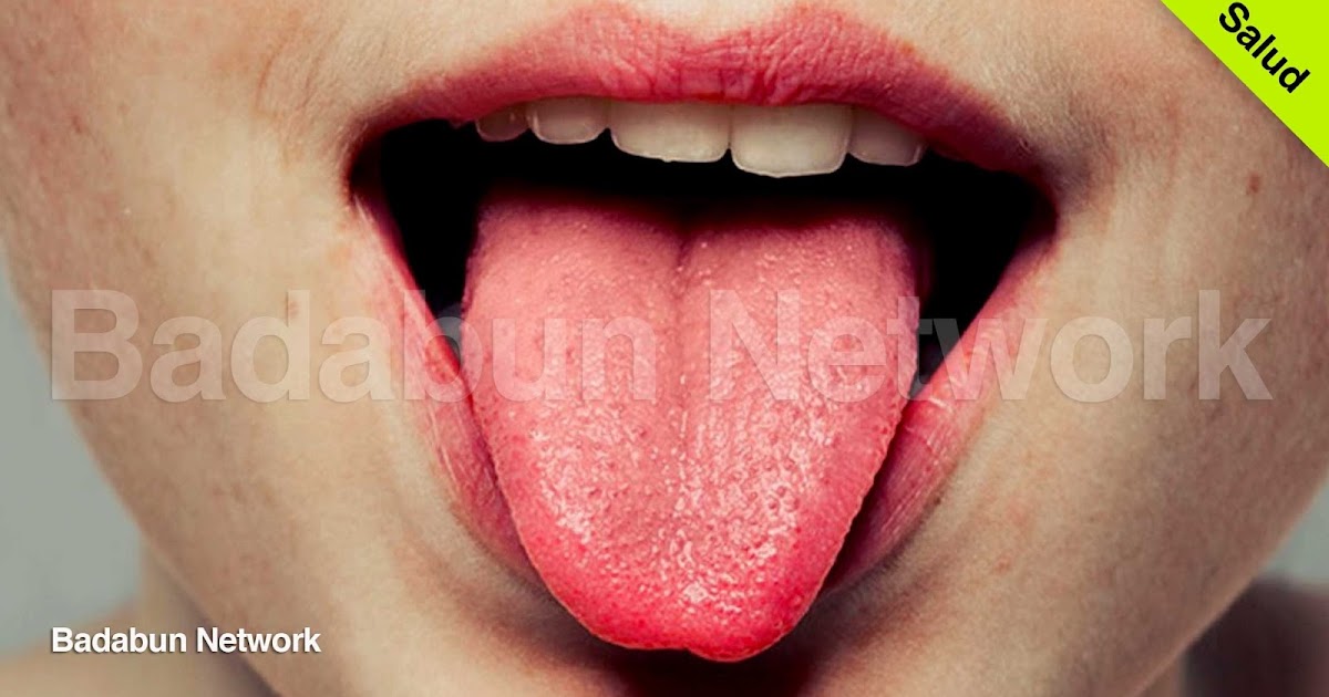 salud lengua color textura ampollas dolor desnutrición encías