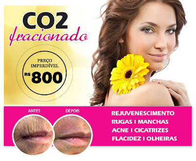 http://www.procorpoplastica.com.br/co2-fracionado.php