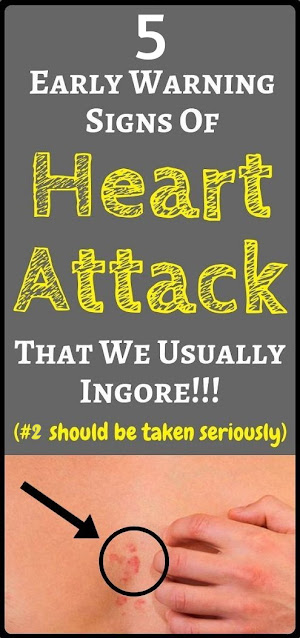 Here Are 5 Warning Signs Of A Heart Attack. All Women Need To Know!!!