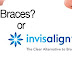 Những trường hợp cần niềng răng invisalign