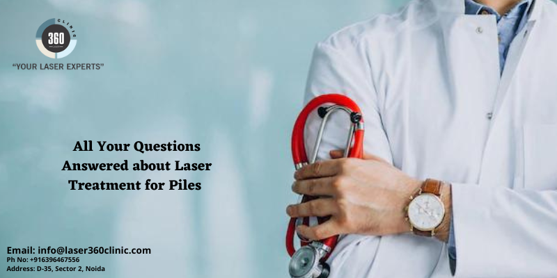 Laser Treatment for Piles