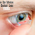 10 Tips to Minimize Eye Infection for Contact Lens Users 