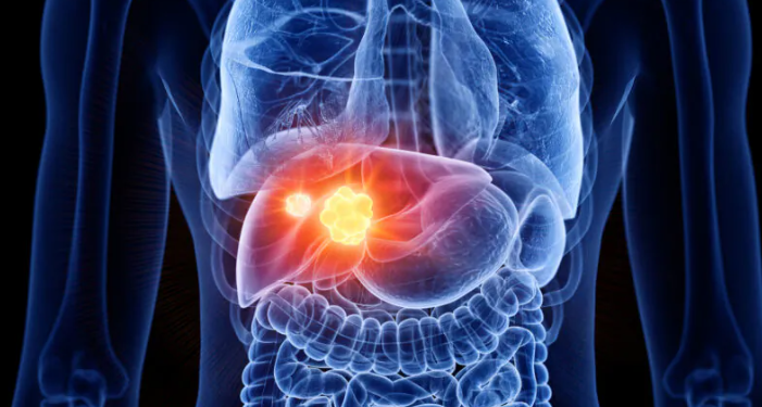 Toxidade no fígado: Overdose de paracetamol tornou-se uma das principais causas de insuficiência hepática nos EUA