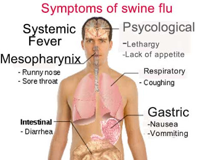 symptoms swine flu