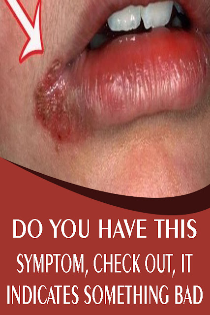 DO YOU HAVE THIS SYMPTOM, CHECK OUT, IT INDICATES SOMETHING BAD