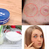 How To Remove Acne, Pimples, Dark Spots And Scars Within 2 Days With This Cream!