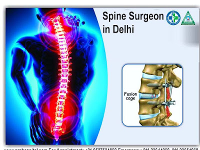 Spine Specialist In New Delhi