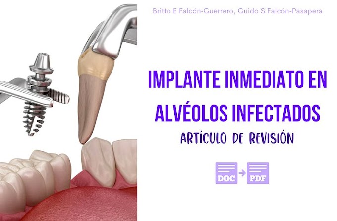 PDF: Implante inmediato en alvéolos infectados - Artículo de revisión